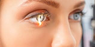 Refractive Surgery – Restore Clear Vision Without Glasses